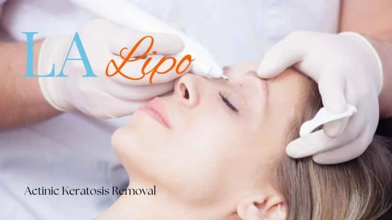 Woman receiving Actinic Keratosis Removal Treatment Holme Chapel