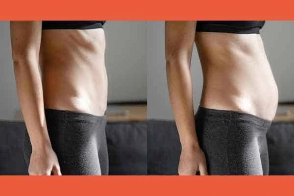 LA-EMS Body Sculpting results Holme Chapel