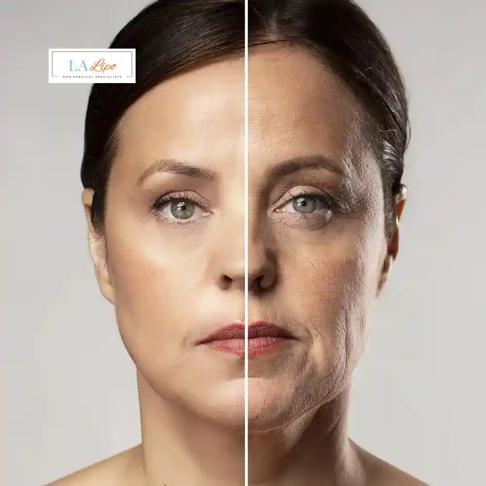 How Can You Tell If Non-Surgical Skin Tightening Is Right for You Holme Chapel?