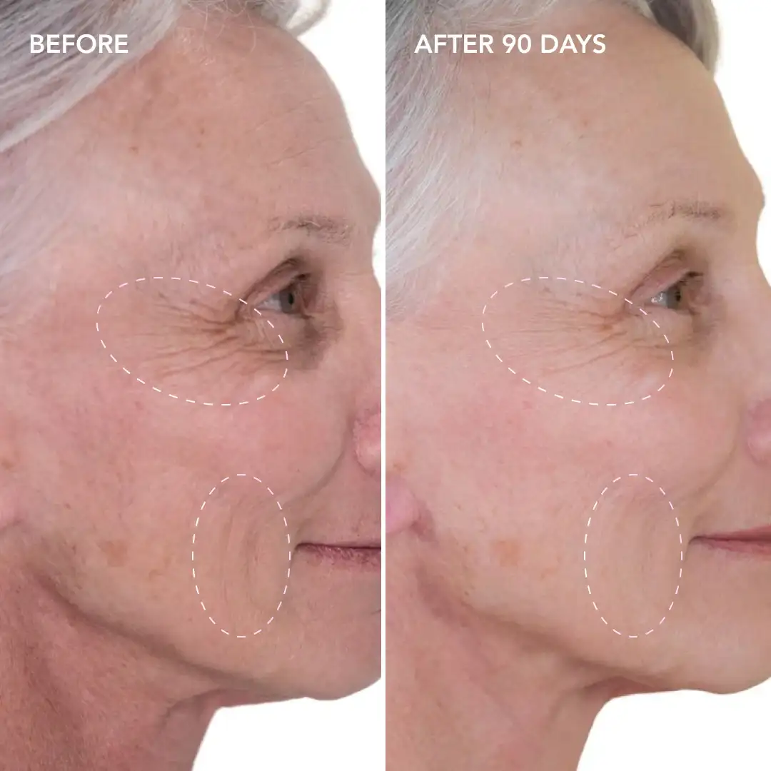 When will you see results Holme Chapel